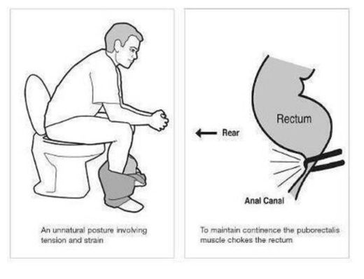 Conventional pooping posture