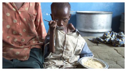 Starving African child