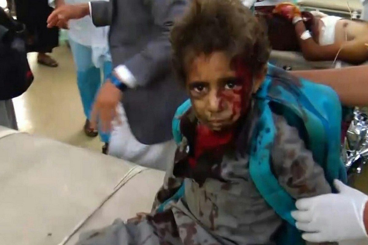 Yemen children airstrike arab saudi