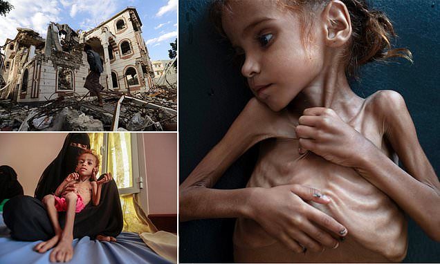 Amal Hussain Yemeni girl starving